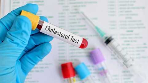 cholesterol-blood-test-tile4
